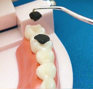 🏆 Ingegneria di precisione tedesca! Punta ultra-fine da 0,1 mm per un uso preciso del filo interdentale✨