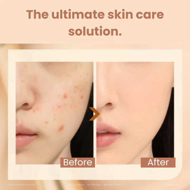 2 in 1 - Fondotinta + correttore antirughe(🔥Acquista 2 e prendi 1 gratis)
