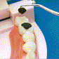 🏆 Ingegneria di precisione tedesca! Punta ultra-fine da 0,1 mm per un uso preciso del filo interdentale✨