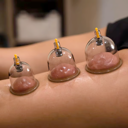 ⏳Offre spéciale à durée limitée⏰Kit de ventouses – Ventouses épaisses, pompe d'aspiration, transparent 🩺