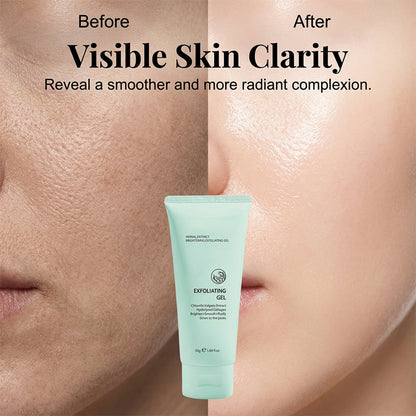 🏆 Offre spéciale du dernier jour : 9,99 € ! 🔥 2 achetés, le 3e offert 🎁 Gel exfoliant éclaircissant aux extraits de plante – Formule douce végétale, exfoliation efficace & soin unifiant pour la peau 🧴